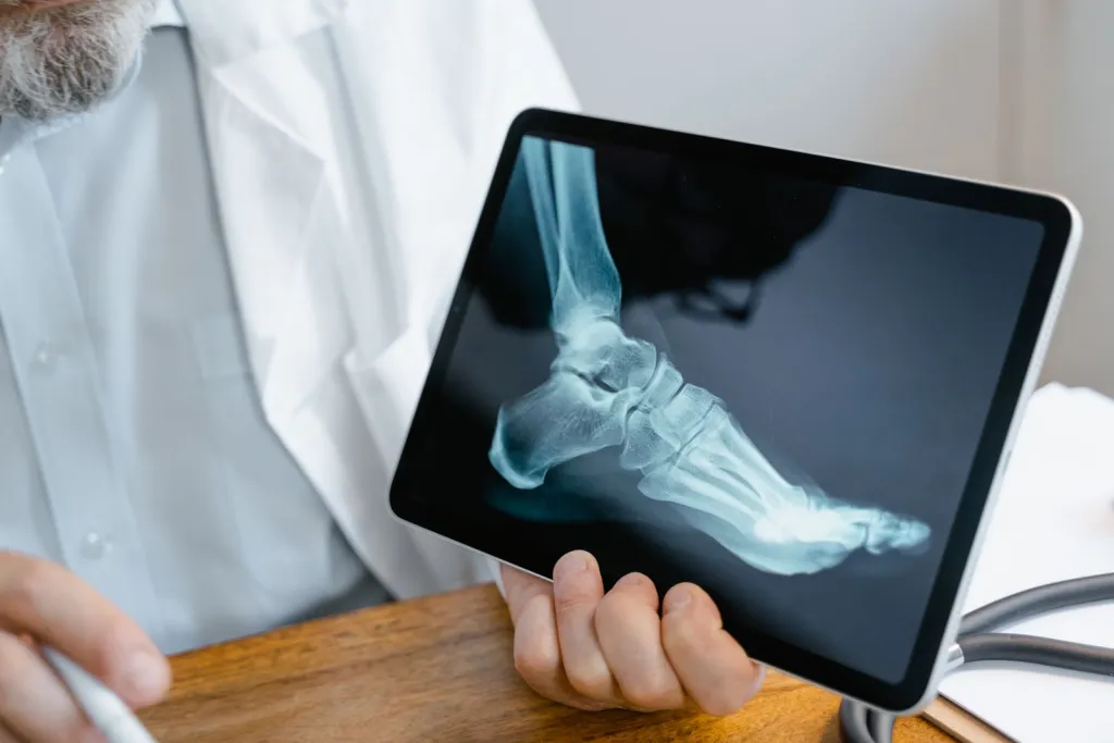 Find Practical Relief for Flatfoot Pain