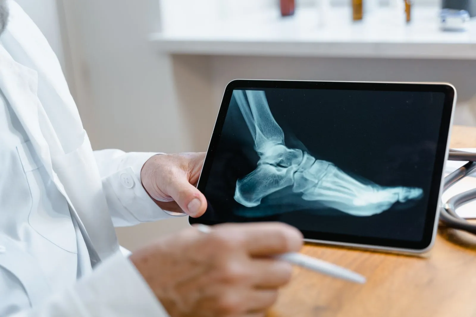 What to Expect at a Flatfoot Evaluation